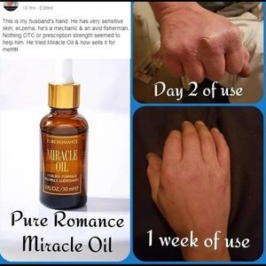 Blow out sale! Pure romance miracle oil !